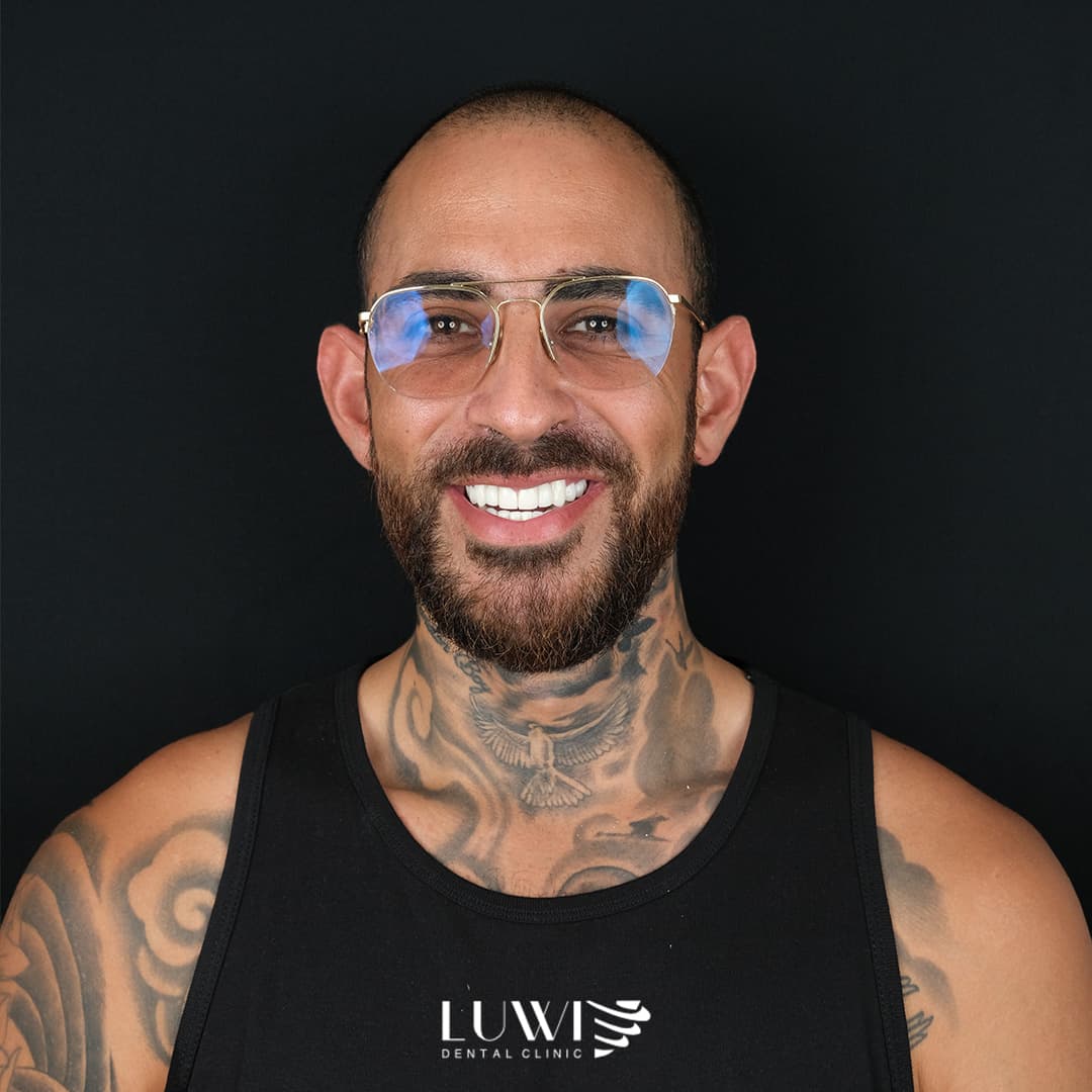 Dental Veneers - Luwi Dental Clinic