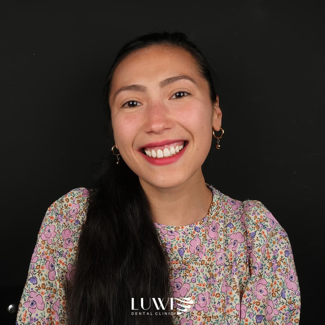Zirconia Crowns - Luwi Dental Clinic