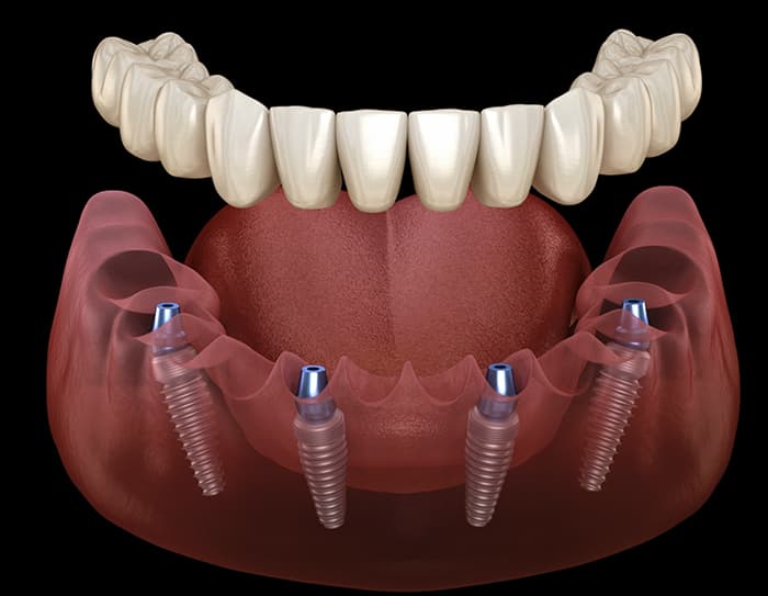 Luwi Dental Clinic - Photo 6