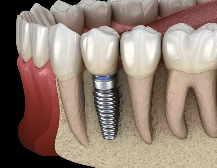 Luwi Dental Clinic - Photo 4